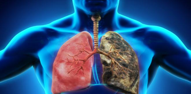 肺癌晚期怎么治疗？怎么选择合