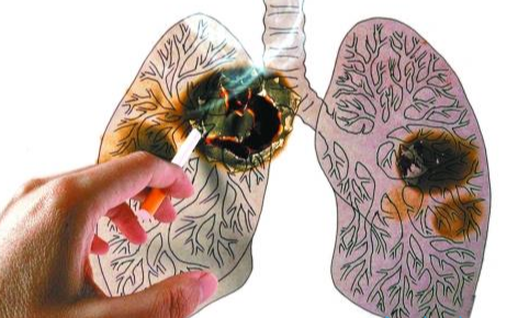 <b>非小细胞肺癌分为哪几种？靶向</b>