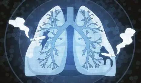 如何缓解肺癌患者的疼痛?