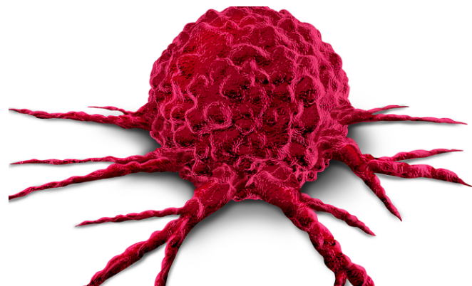 癌症筛查 癌细胞扩散 前列腺特异性