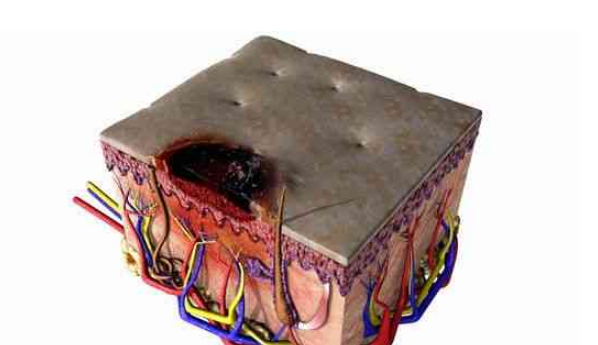 肥胖与黑色素瘤男性生存期延长有关