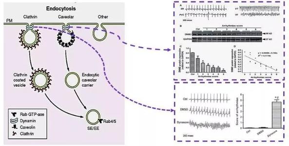 心脏离子通道病