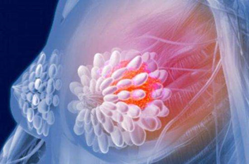 <b>玻玛西林用于晚期乳腺癌效果如</b>