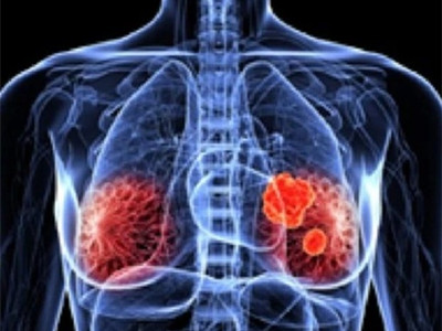 <b>玻玛西林哪里有卖？</b>