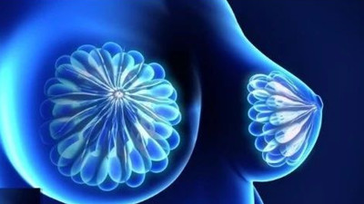 <b>乳腺癌使用Abemaciclib治疗效果好</b>