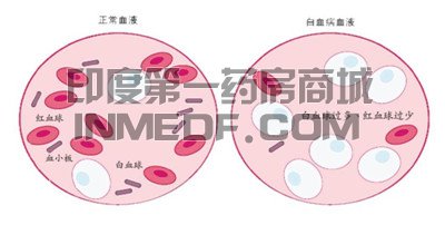 <b>吃普纳替尼发烧了怎么办？</b>