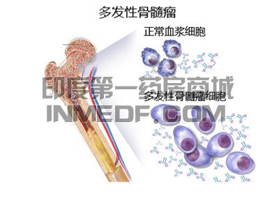 <b>泊马度胺最大日剂量是多少？</b>