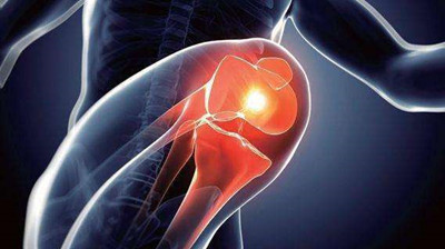 巴瑞克替尼 巴瑞克替尼