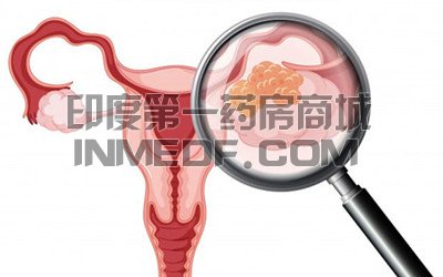 <b>奥拉帕尼治疗复发性卵巢癌如何</b>