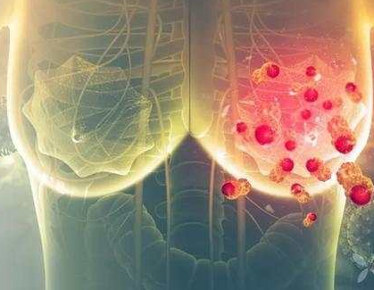 治疗三阴乳腺癌(TNBC)的靶向药有