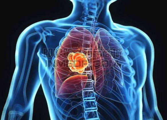 Trilaciclib优先治疗化疗后的小细胞肺癌