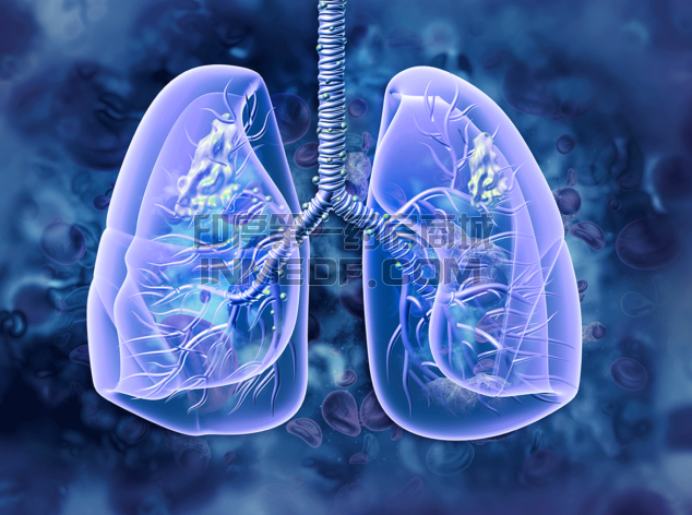 非小细胞肺癌新药Rybrevant（amivantamab-vmjw）注射剂