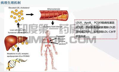 家族性高胆固醇血症