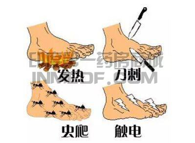 糖尿病周围神经痛