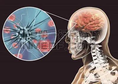 阿米巴性脑膜炎