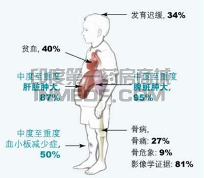 <b>治疗戈谢病(GD)药物是哪些？</b>