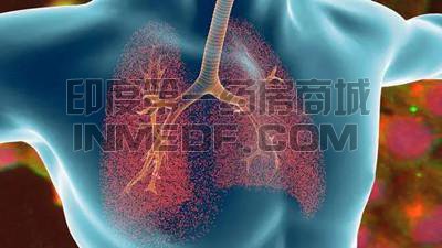 17种治疗肺囊性纤维化(CPF)的药物