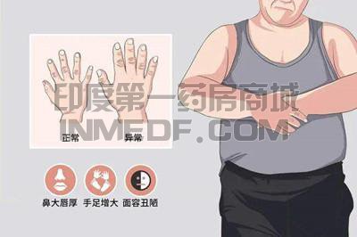 <b>治疗肢端肥大症的5种药物是什</b>