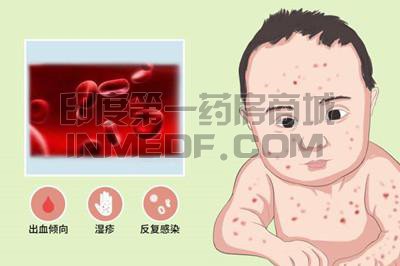 湿疹血小板减少伴免疫缺陷综合症