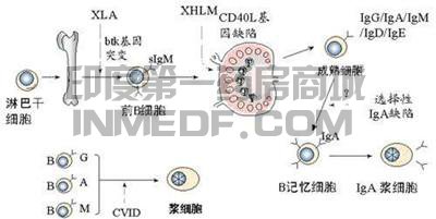 X-连锁无丙种球蛋白血症