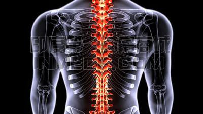 肌强直性营养不良