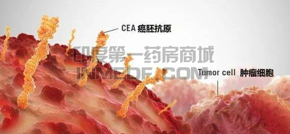 肿瘤标志物，癌胚抗原（CEA）高