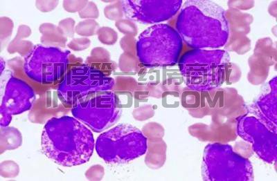4种急性早幼粒细胞白血病