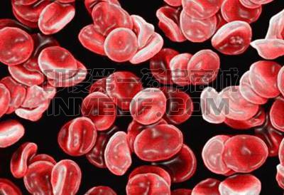 低碱性磷酸酶血症