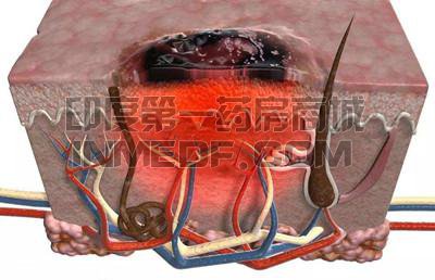 18种治疗黑色素瘤的靶向药/免疫疗法